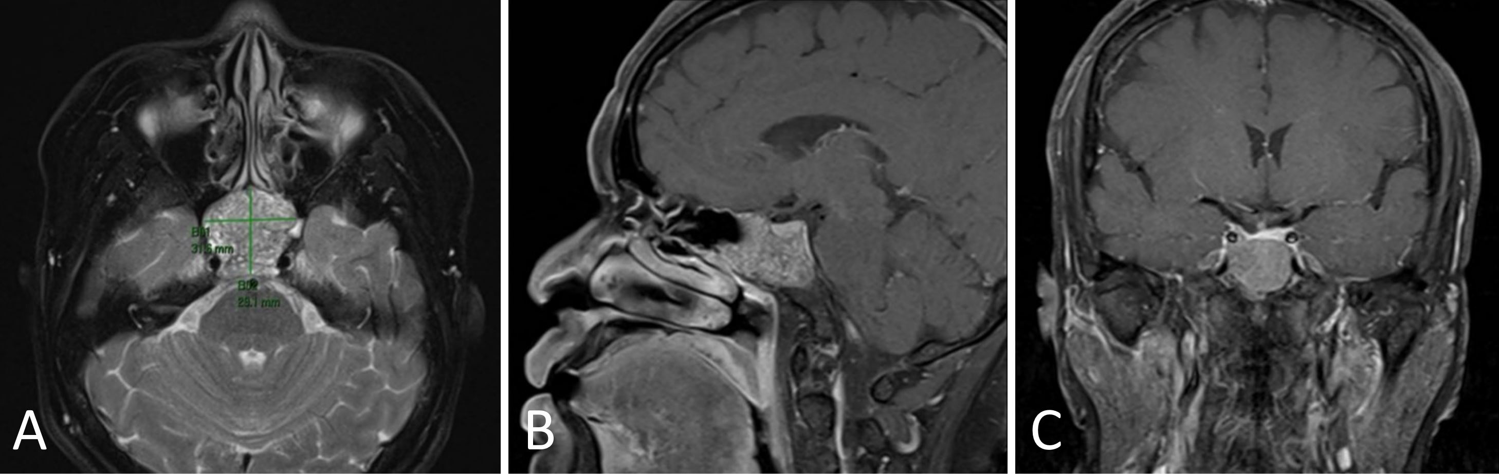 Figure 2.JPG